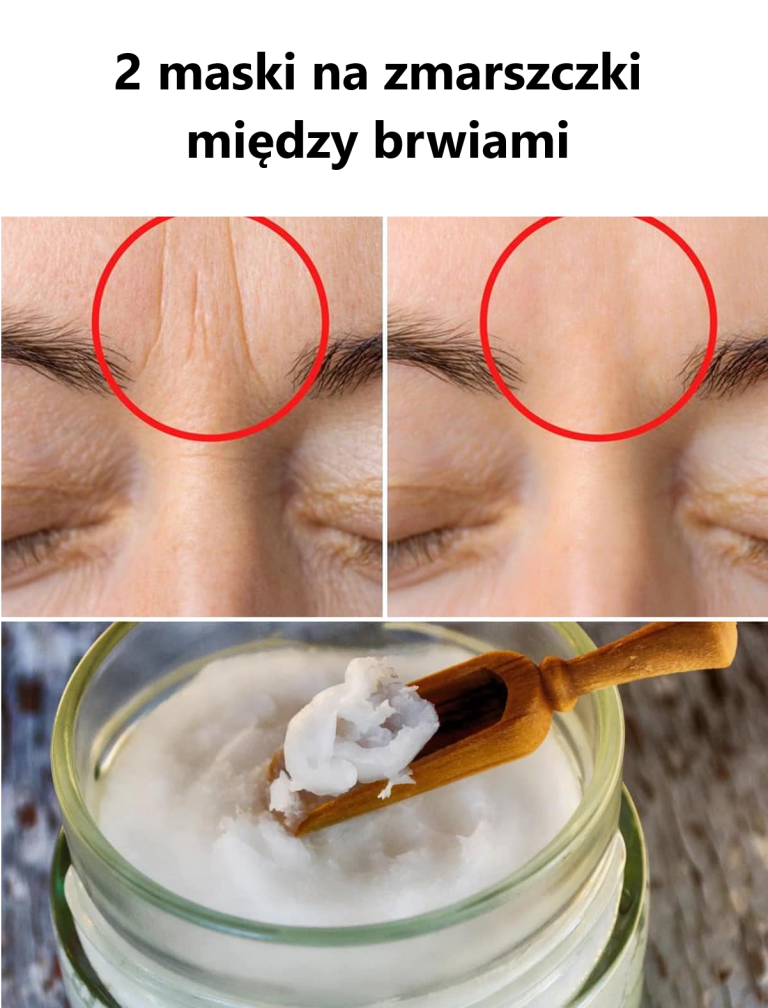 2 maski na zmarszczki między brwiami