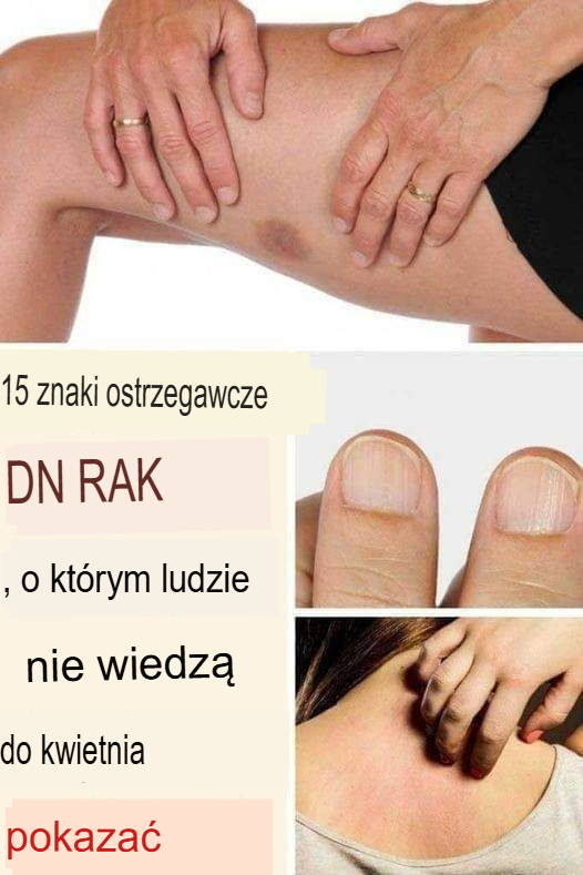 15 Ostrzegawczych sygnałów raka, które często są ignorowane