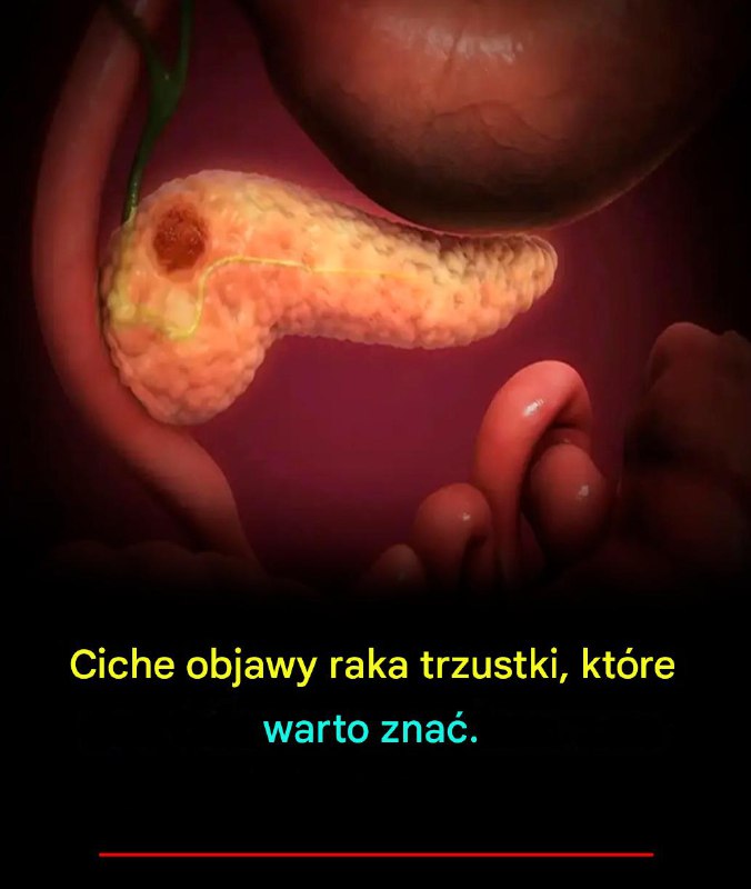 Ciche objawy raka trzustki, które warto znać