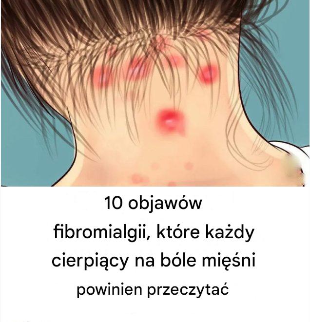 10 objawów fibromialgii, które każdy z bólem mięśni powinien przeczytać