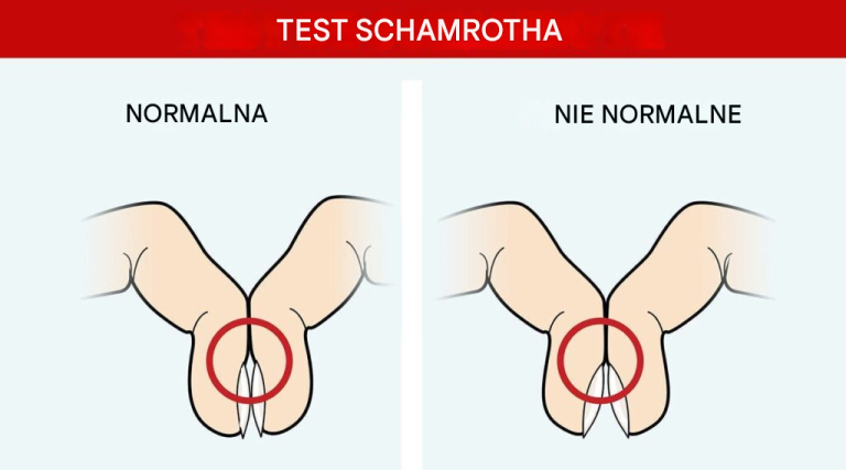 Ten prosty test palca może ujawnić objawy raka płuc i innych problemów zdrowotnych