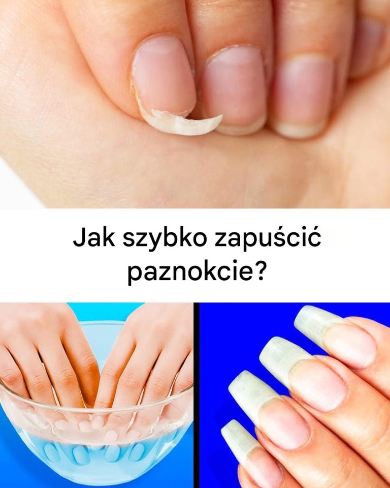 Jak Szybko Zapuścić Paznokcie?