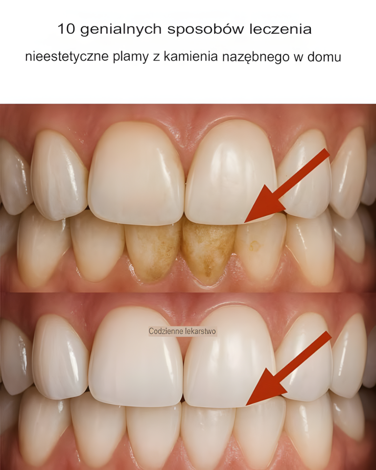 10 genialnych sposobów na walkę z nieestetycznym kamieniem nazębnym