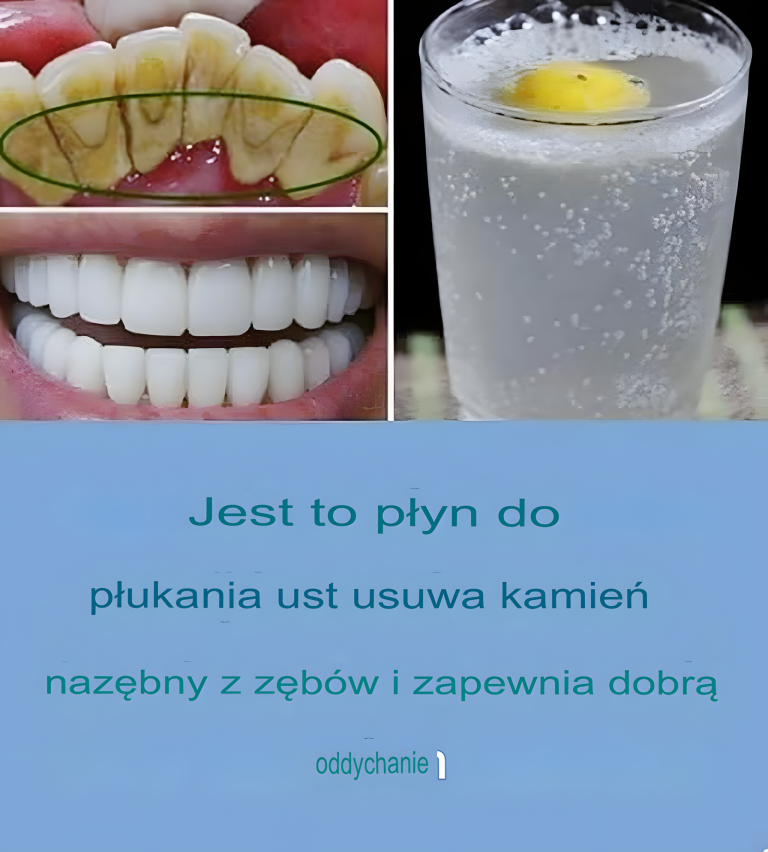 Ten płyn do płukania jamy ustnej naturalnie usuwa kamień nazębny