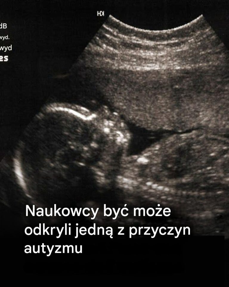 A co jeśli autyzm pozostawia niewidoczny ślad od urodzenia?