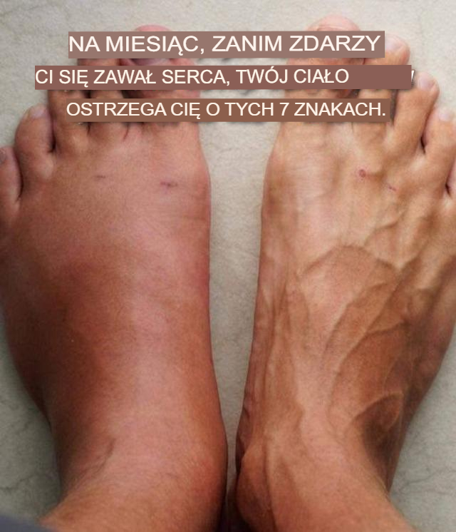 Miesiąc przed zawałem serca organizm wysyła 7 sygnałów ostrzegawczych.