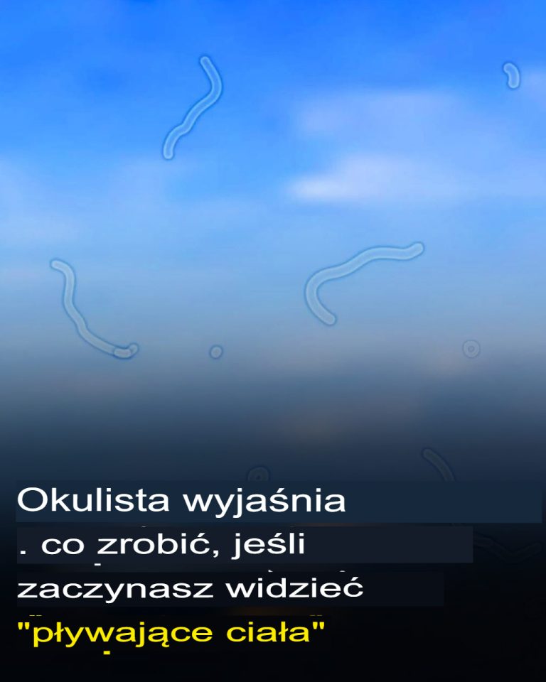 Czym są męty? Oto co powinieneś zrobić, jeśli je zobaczysz