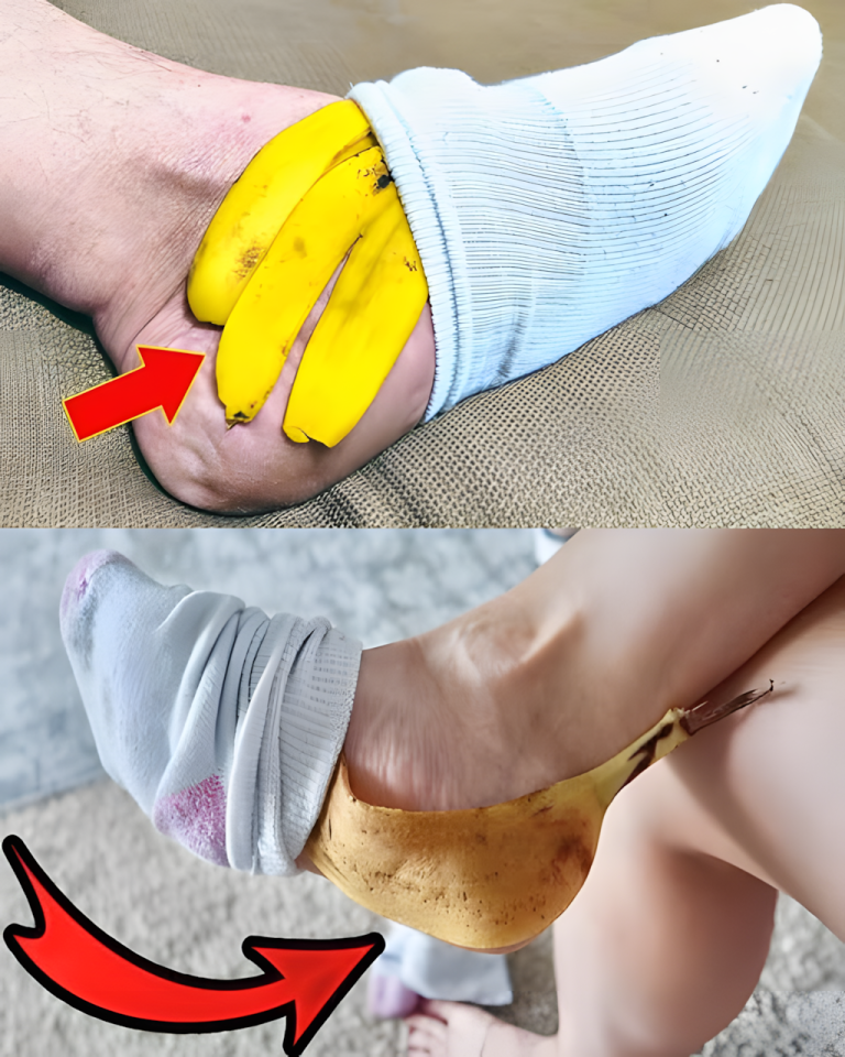 Skórka banana na stopach: zaskakujący naturalny środek