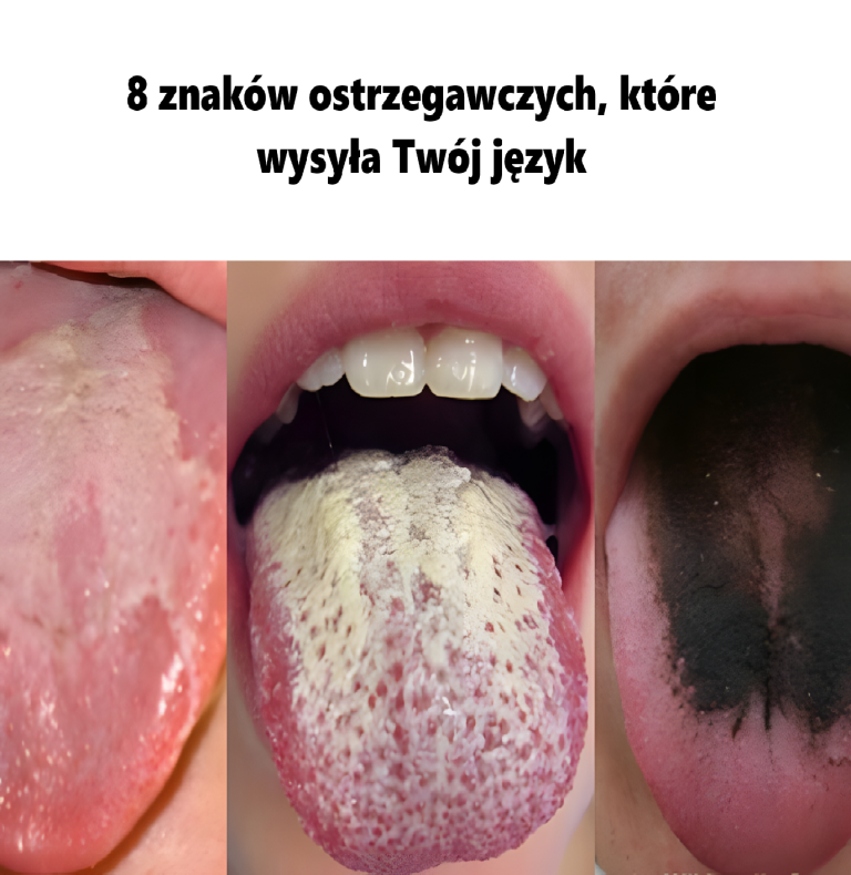 8 znaków ostrzegawczych, które wysyła Twój język