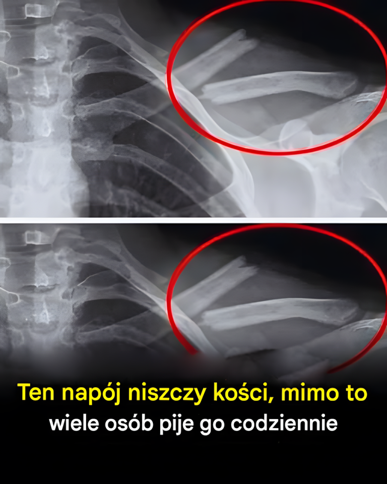 Ten napój niszczy kości, mimo to wiele osób pije go codziennie