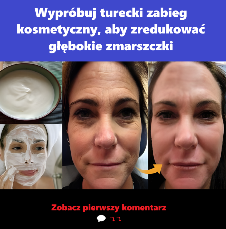 Wypróbuj turecki zabieg kosmetyczny, aby zredukować głębokie zmarszczki