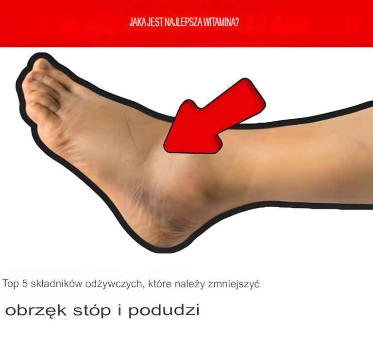 5 najlepszych składników odżywczych, które zmniejszają obrzęk stóp i nóg