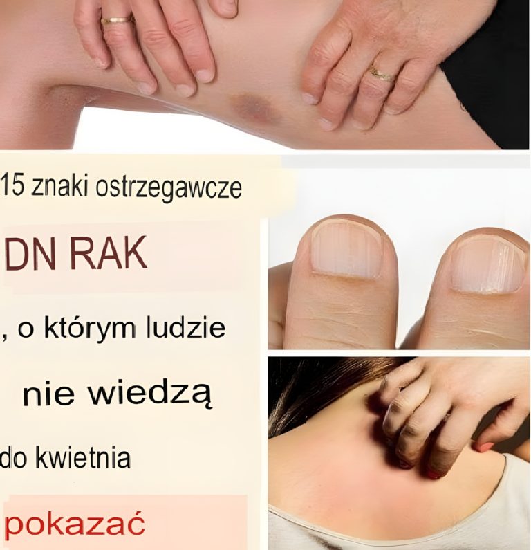 15 Ostrzegawczych sygnałów raka, które często są ignorowane