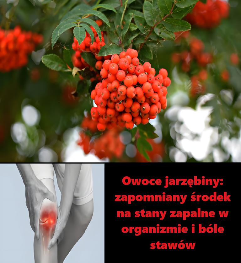 Owoce jarzębiny: zapomniany środek na stany zapalne w organizmie i bóle stawów. I nasze babcie już o tym wiedziały. Jak cenne dla naszego zdrowia są owoce jarzębiny?