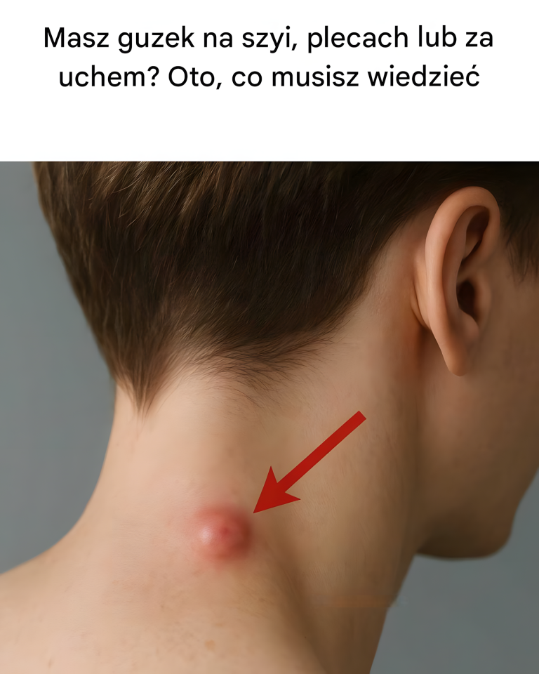 Bądź ostrożny❗ 🩺 Guzek na szyi, plecach lub za uchem? Dowiedz się, co może oznaczać i jak postępować!