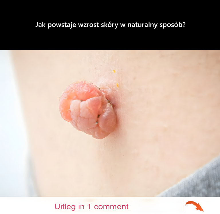 Jak powstaje wzrost skóry w naturalny sposób?