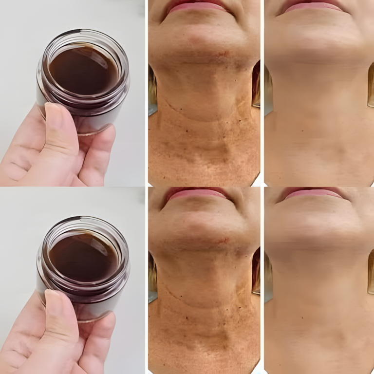 Jak naturalnie usunąć oznaki starzenia?