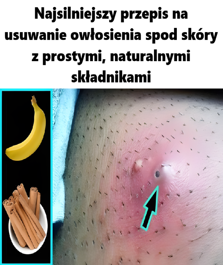 Najsilniejszy przepis na usuwanie owłosienia spod skóry z prostymi, naturalnymi składnikami